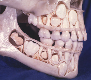 lebka so zubami